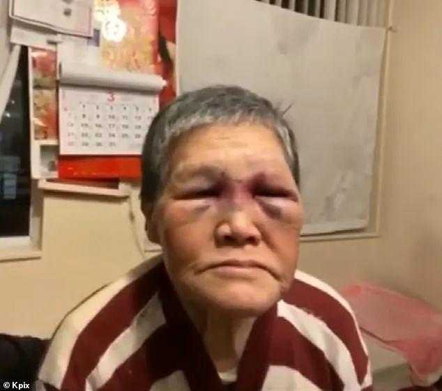 霸气! 76岁华裔阿婆遇袭 操木棒将白男打到满脸血 抬上担架! 网友爆赞 社会 第15张
