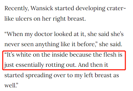 恐怖! 高烧一个月 双侧乳房腐烂 27岁女孩被Omicron后遗症折磨 痛苦不堪 新闻 第7张