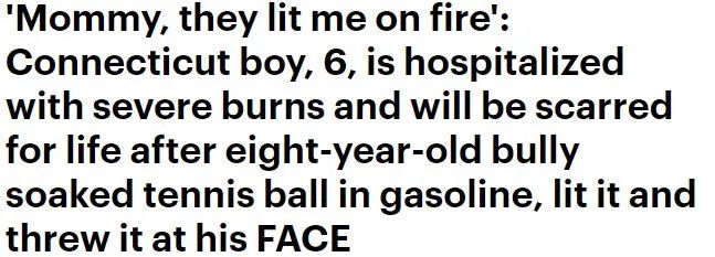 惨! 6岁男孩被同伴点燃 浑身是火 重度烧伤! 在场的全冷漠围观… 新闻 第3张